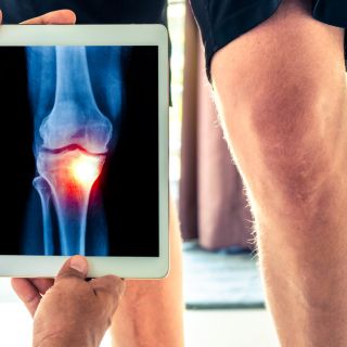 Miglioramento delle prestazioni